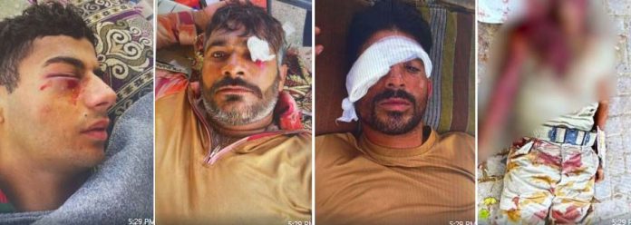 Mob attack in Gwadar leaves Sepoy Shabbir Baloch martyred