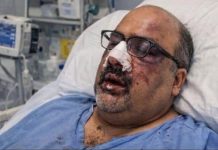 Shahzad Akbar says injured in assault near Cambridge home
