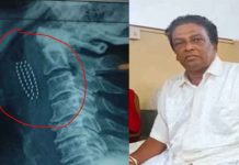 Brushing teeth turns life-threatening for Sri Lankan man Brushing teeth turns life-threatening for Sri Lankan man