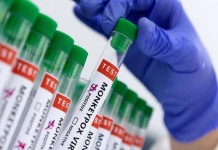 Pakistan registers second mpox-linked death